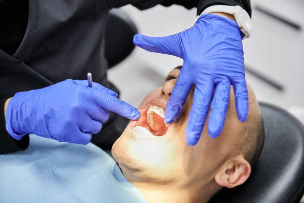 Best Emergency Tooth Extraction in Sawmills, NC