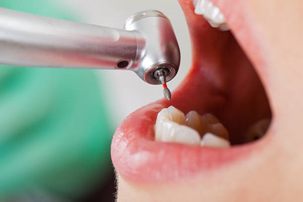 Best Pediatric Emergency Dentist in Sawmills, NC